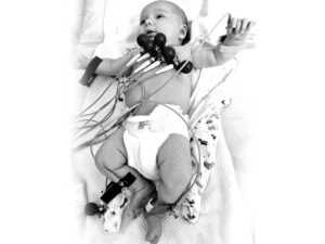 O Nanny baby monitor monitoriza a respiração debebês em unidades de saúde em todo o mundo.